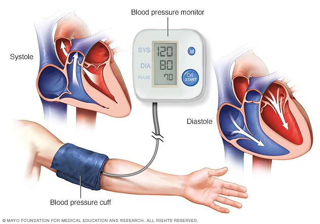 Hypertension 2