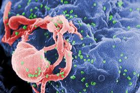 Image result for HIV